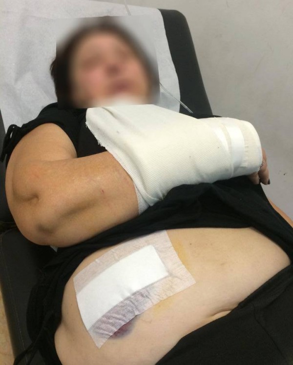 Στο νοσοκομείο από επίθεση σκύλου