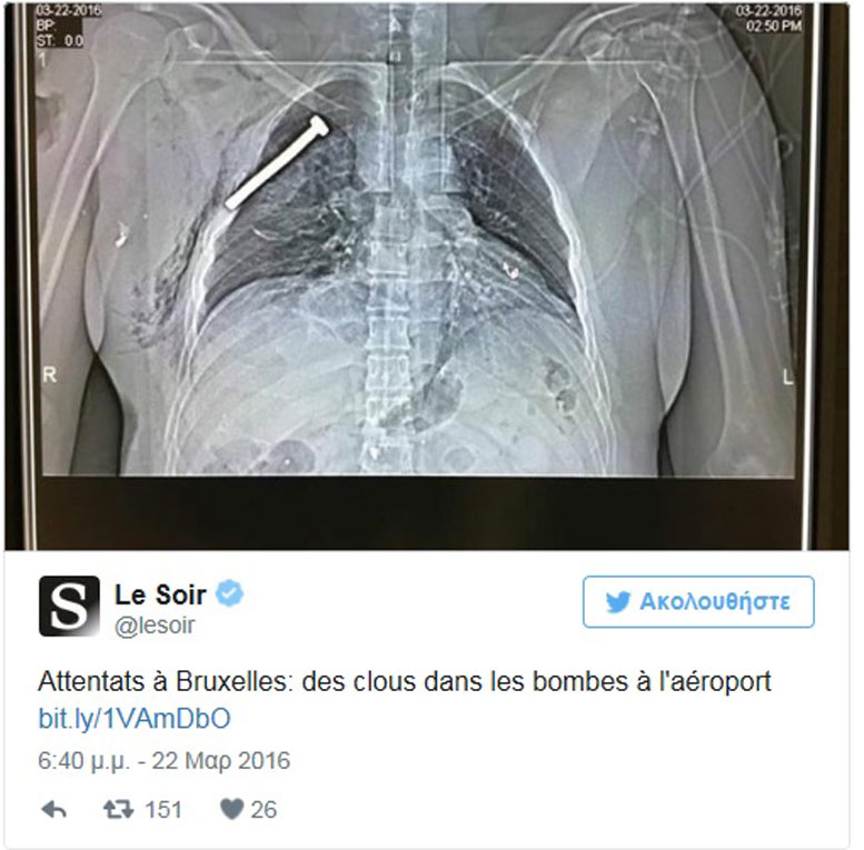 βιδα