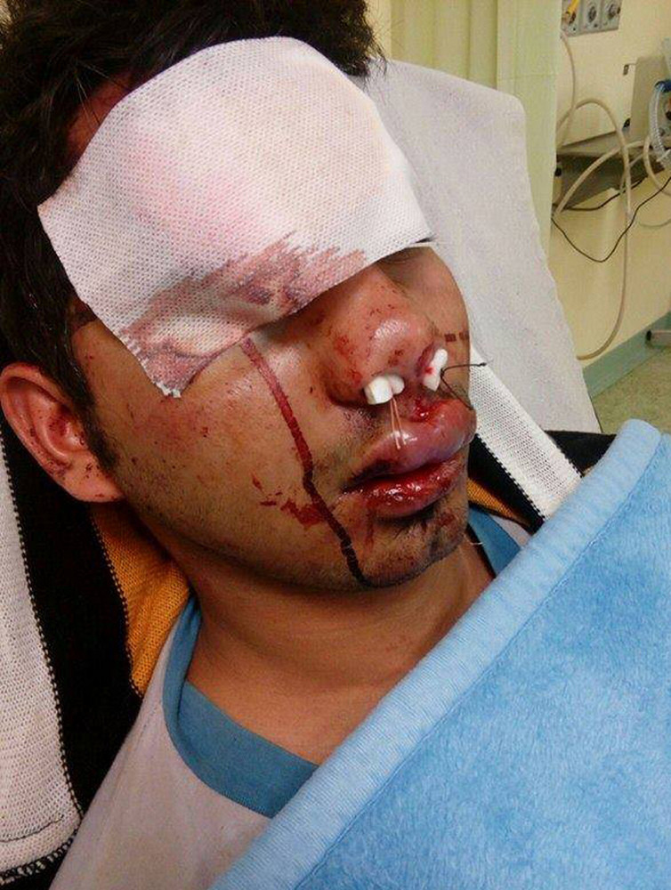 ΠΑΚΙΣΤΑΝΟΣ