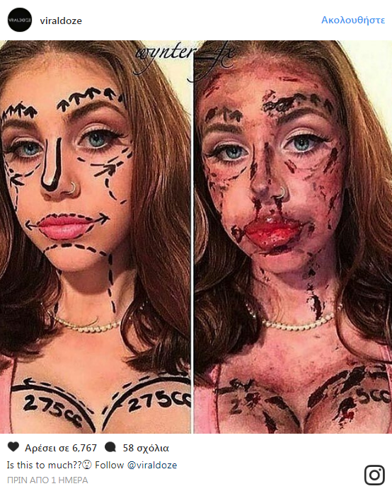 lol