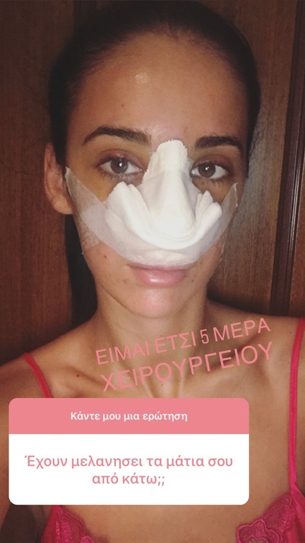ΦΩΤΟ